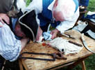 Cauterizing the Blood Vessels